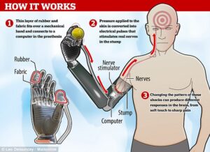 prosthetic limb