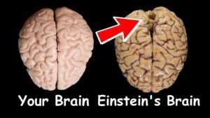 Extra ordinary brain of Einstein